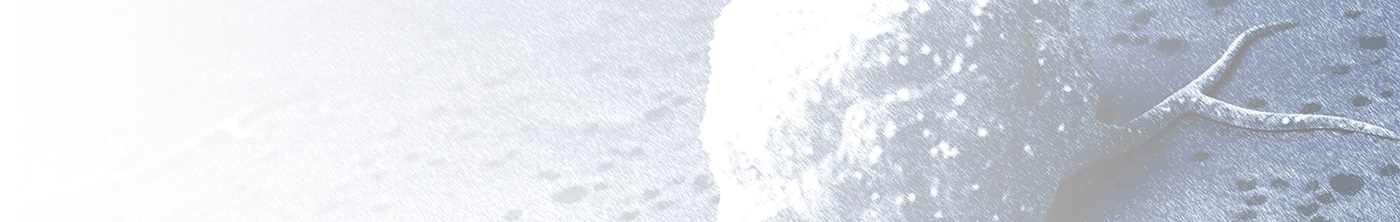 ONCO-HU<sup>® </sup>模型