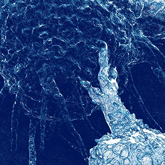 PDX LIVE<sup>™</sup> 肿瘤模型